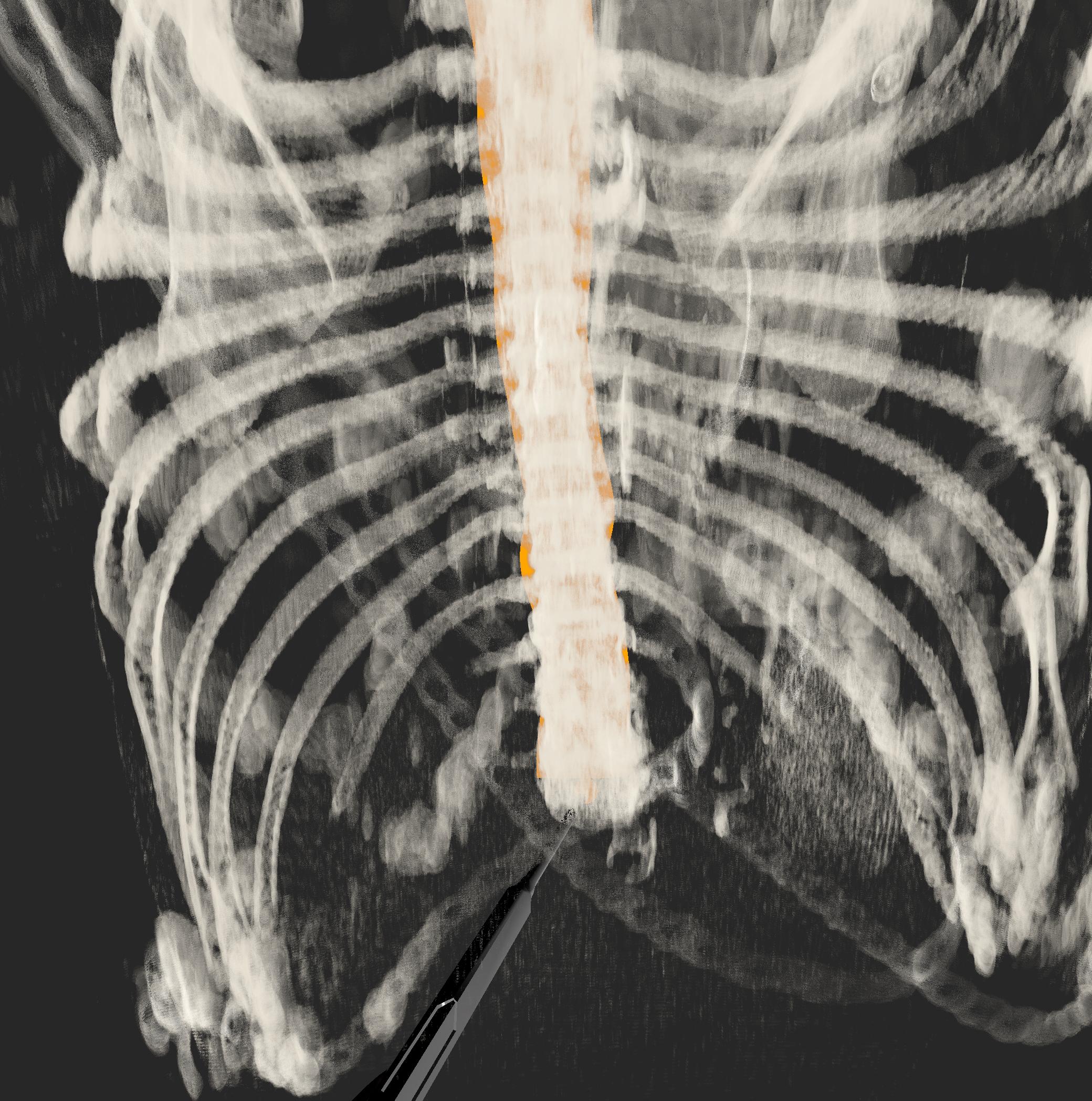 XR Medical Imaging Preview