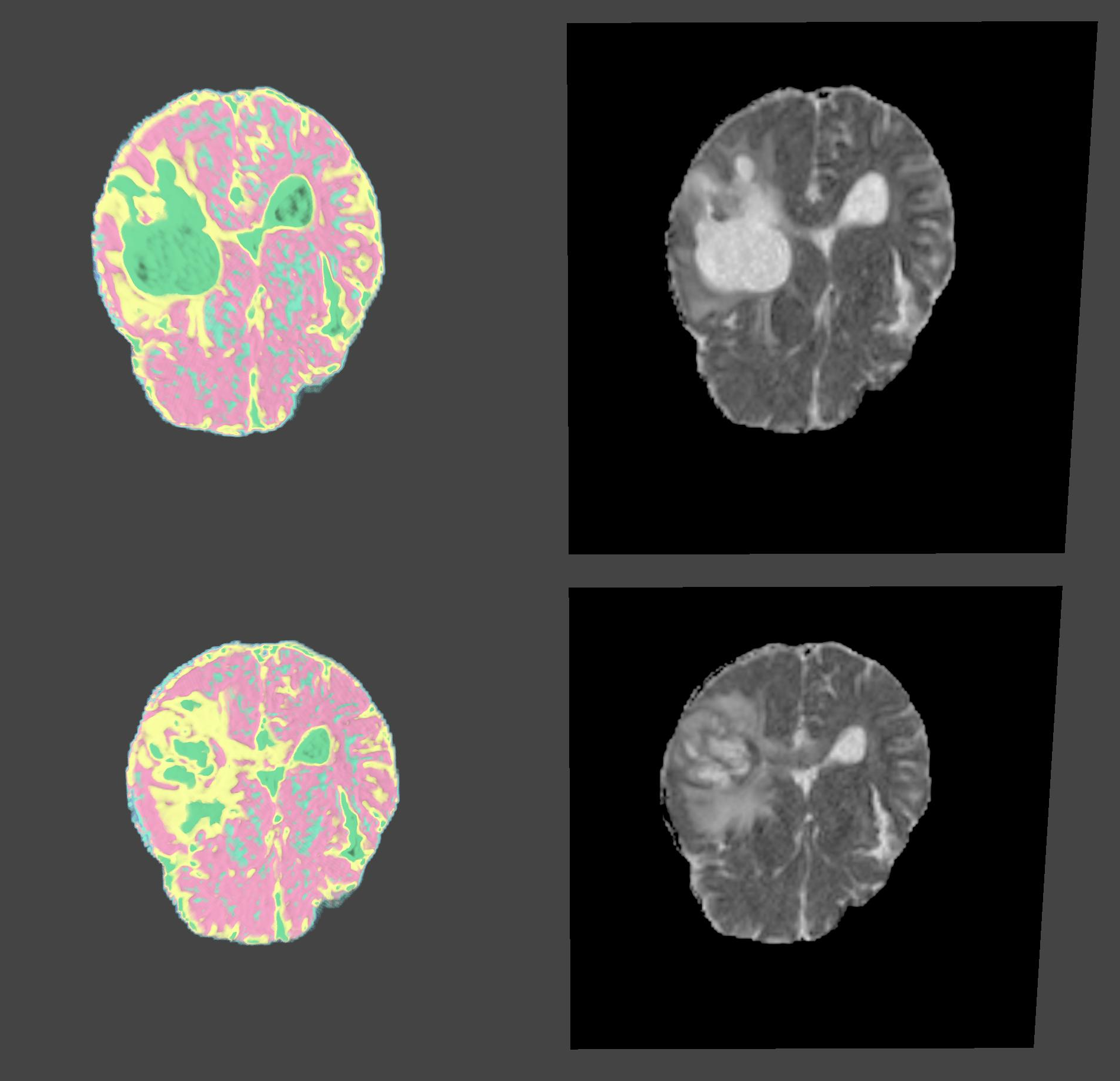 Comparison of longitudinal medical imaging datasets